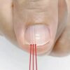 Noticing Vertical Nail Ridges After 40? Here’s What Your Nails Might Be Telling You
