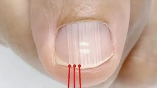 Noticing Vertical Nail Ridges After 40? Here’s What Your Nails Might Be Telling You