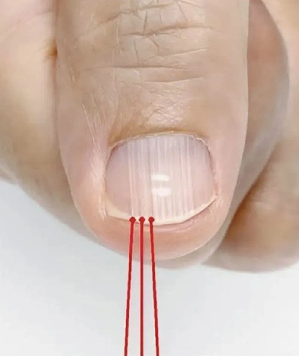 Noticing Vertical Nail Ridges After 40? Here’s What Your Nails Might Be Telling You